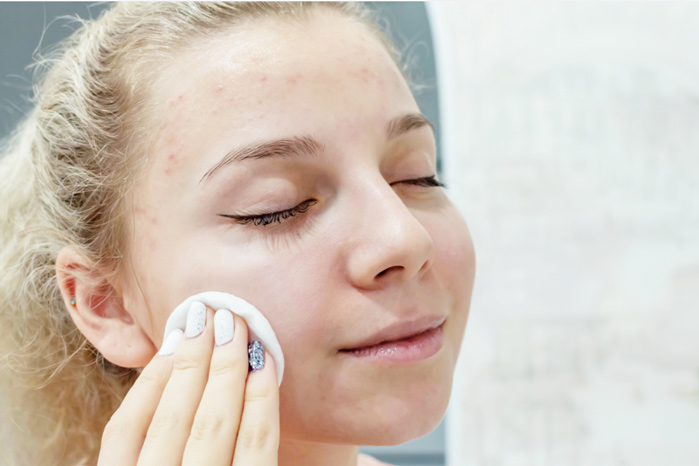 Acne Resurfacing Pads woman