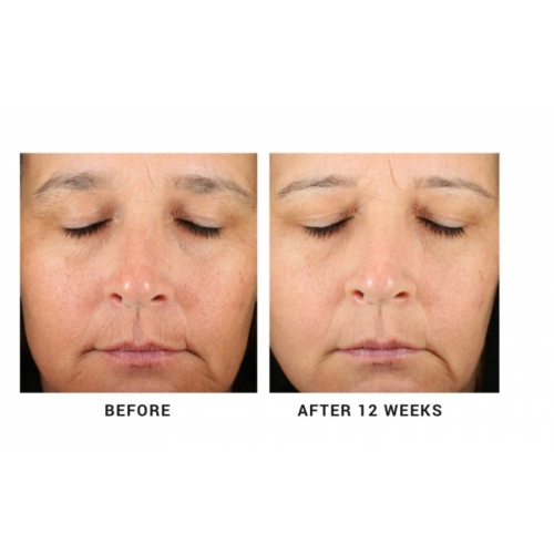 Concentrated Retinol Serum 5X image 3