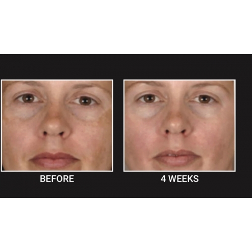 Brightening Defying Pads image 4